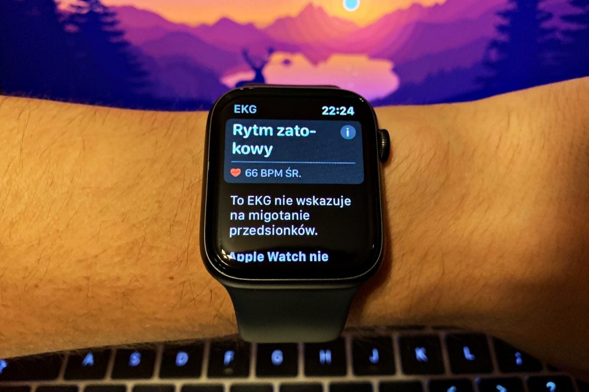 Apple Watch pomiar EKG