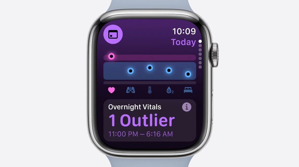 watchOS 11