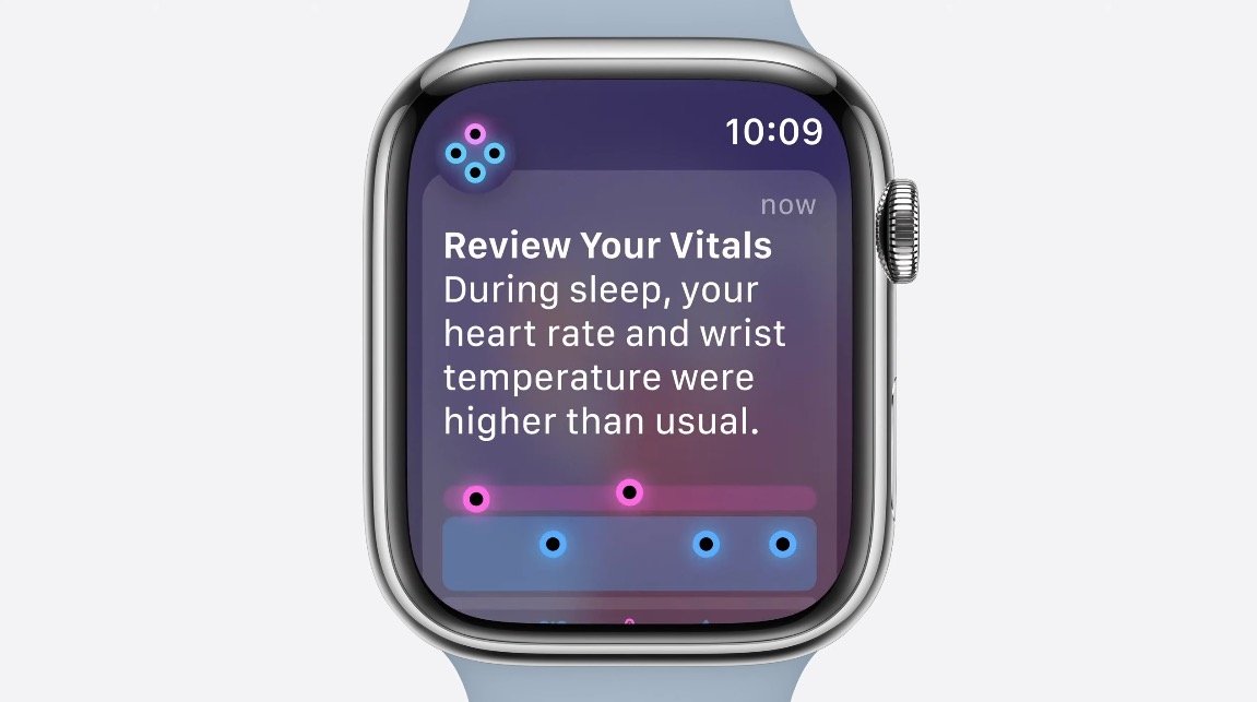 watchOS 11