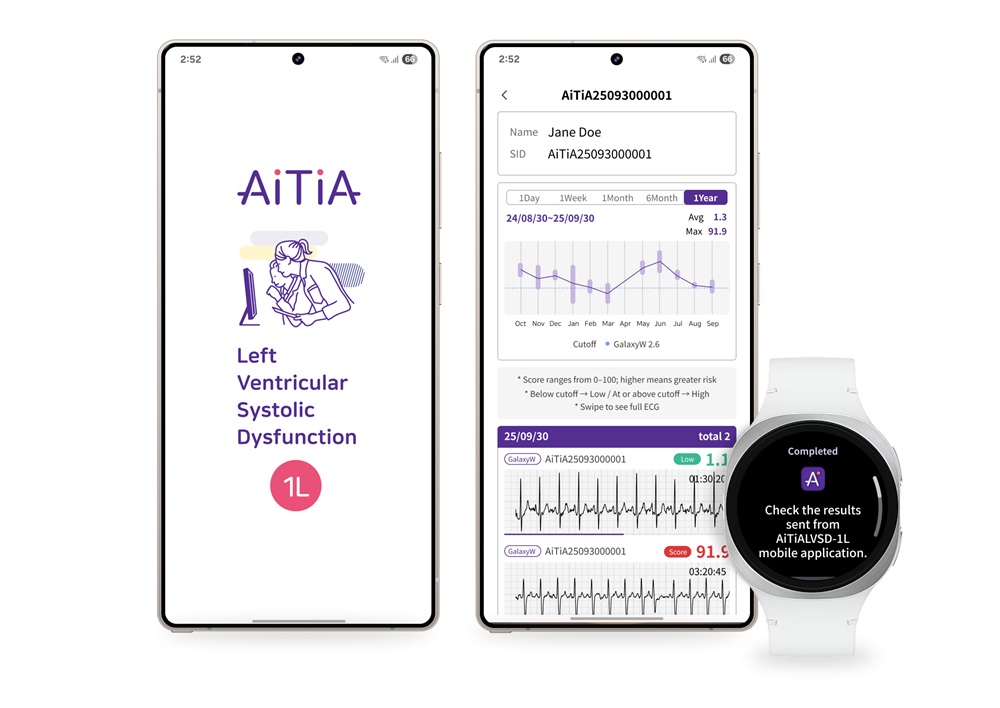 Samsung, wykrywanie LVSD, choroby serca, smartwatch